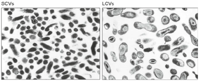 Dos morfologías de Coxiella burnetii: una grande intraceluar (LCVs) y otra pequeña, de espero (SCVs).